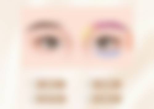 压力疗法适用于哪种疤痕印子？