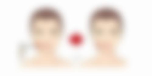 切眼袋手术入路不同，上班时间也不同吗？