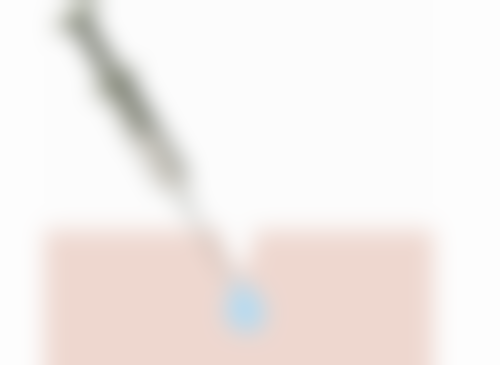 20多年的疤痕怎么办？试试激光修复、手术切除，多种方法助你淡化消除疤痕！ 