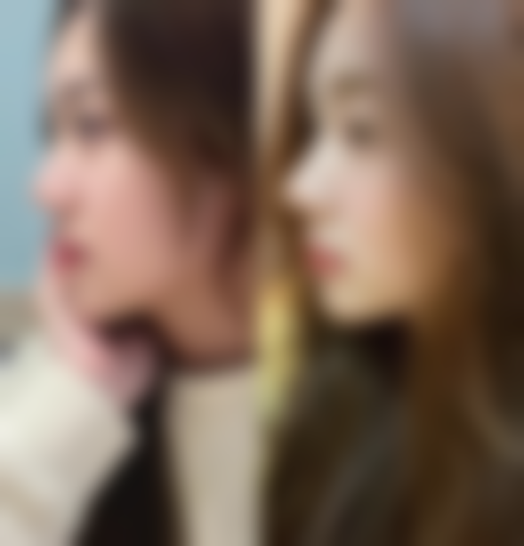 晚上做双眼皮手术效果好吗？手术时间与效果关联不大，关键在医生技术和个人体质 