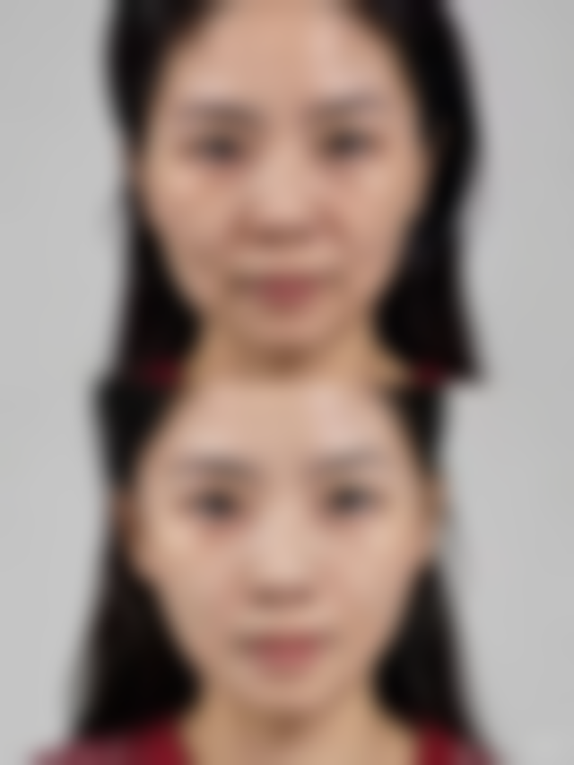 保定美琪整形医院口碑评价怎么样？