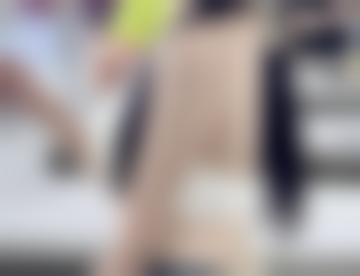 保定美琪整形医院正规吗？