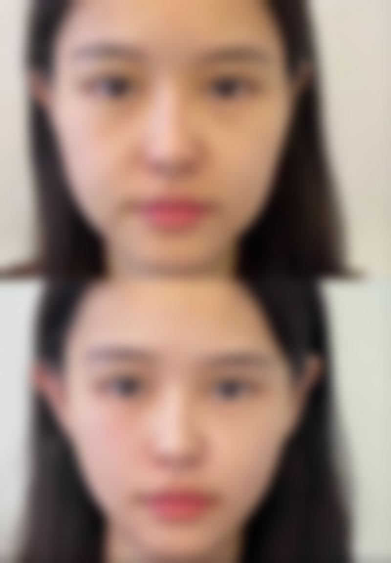 药物能治疗20多年的疤痕吗？