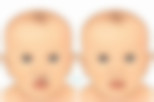 激光修复疤痕好吗？它能精准作用、刺激再生，改善外观且安全性高效果显著！ 