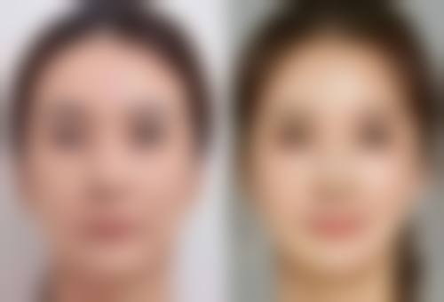 深圳永秀医疗美容门诊部怎么预约