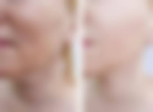 连云港索妃特医疗美容门诊部口碑评价怎么样?