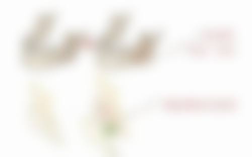 隆胸假体取出需要全麻吗？手术时间、恢复周期与麻醉方式有什么关系你了解吗？ 