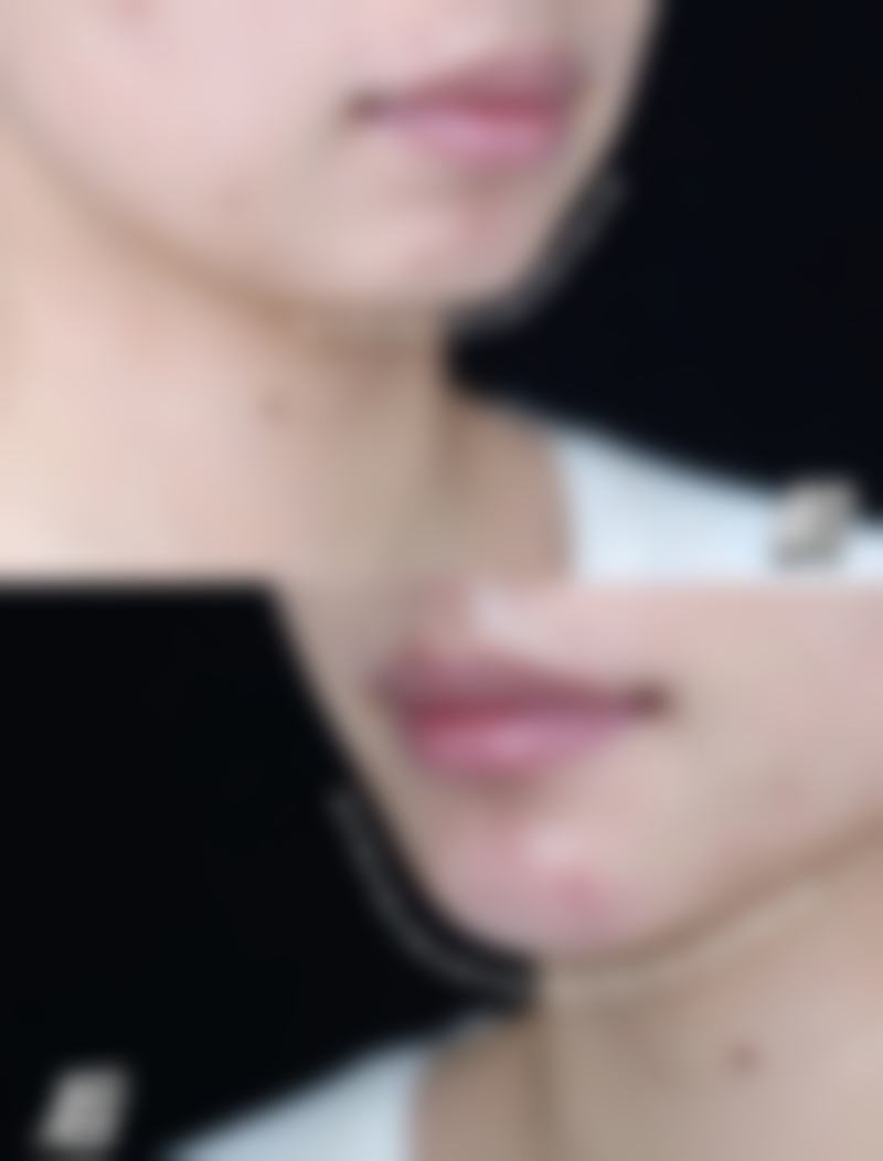 德州圣韩美整形美容医院怎么预约？