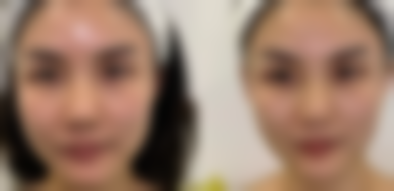 成都蓉雅晶肤医疗美容门诊部正规吗？