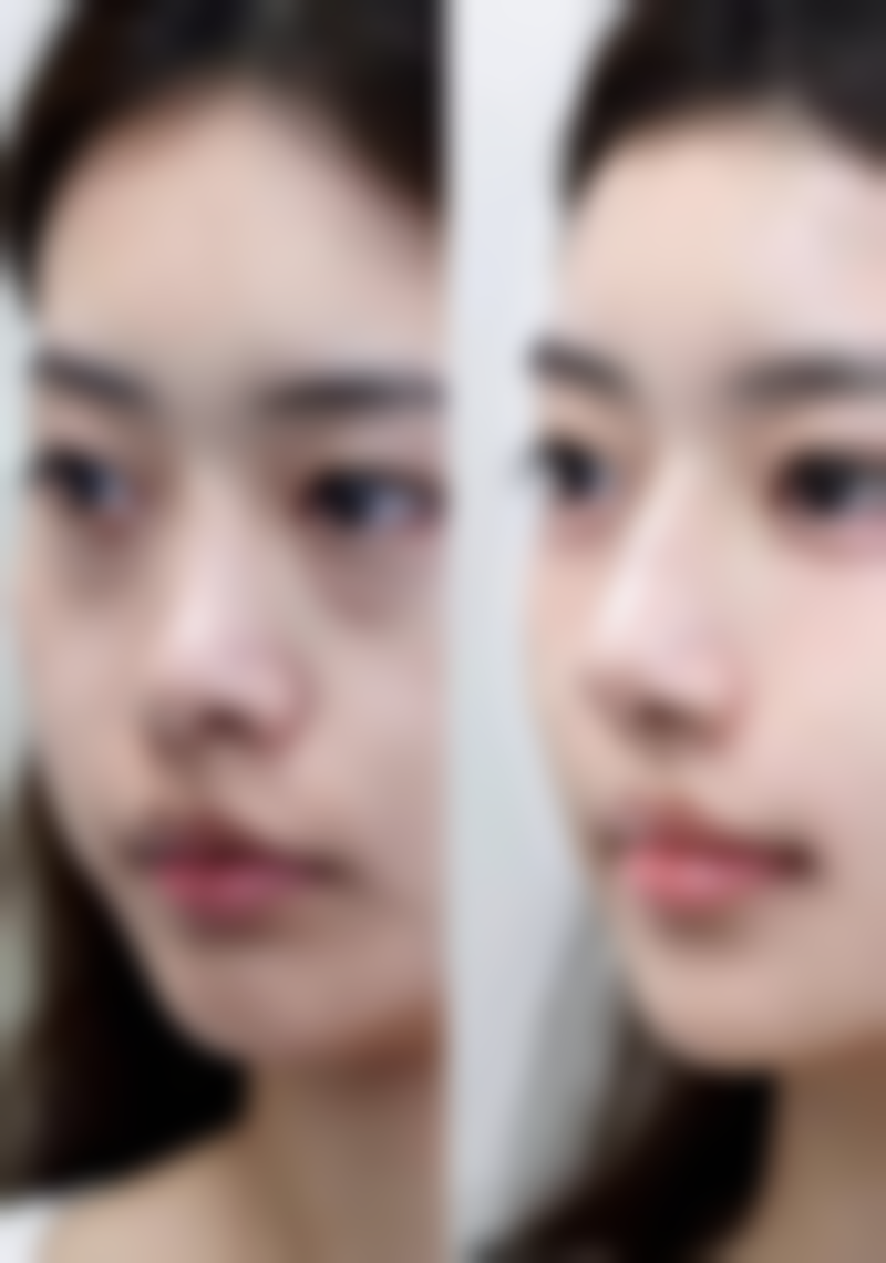 为什么宝宝睡醒时会出现双眼皮呢？