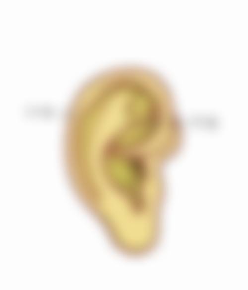 眼袋怎么消除效果好？试试这些医美手段、日常护理方法，让你告别“熊猫眼”！ 