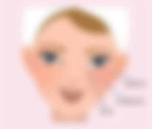 无痕双眼皮术后成效不理想,和拆线有关系吗?