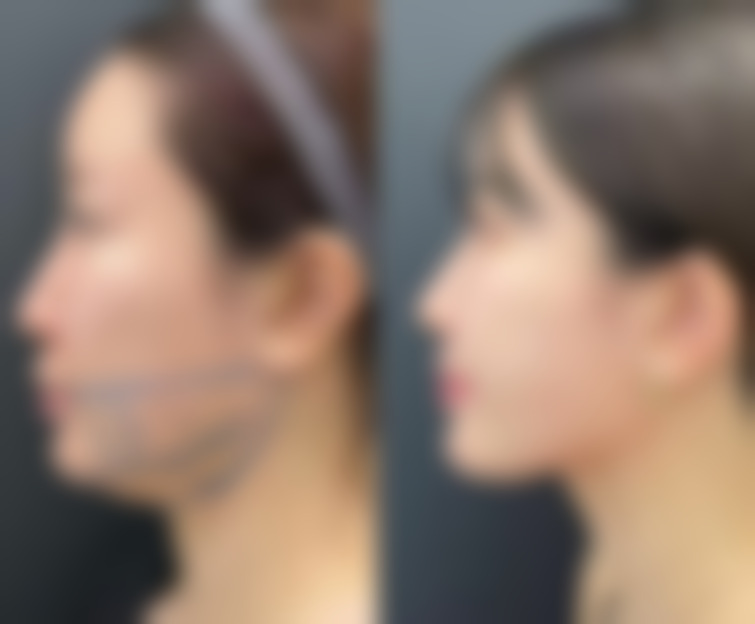 达州觅己医疗美容诊所收费价格表