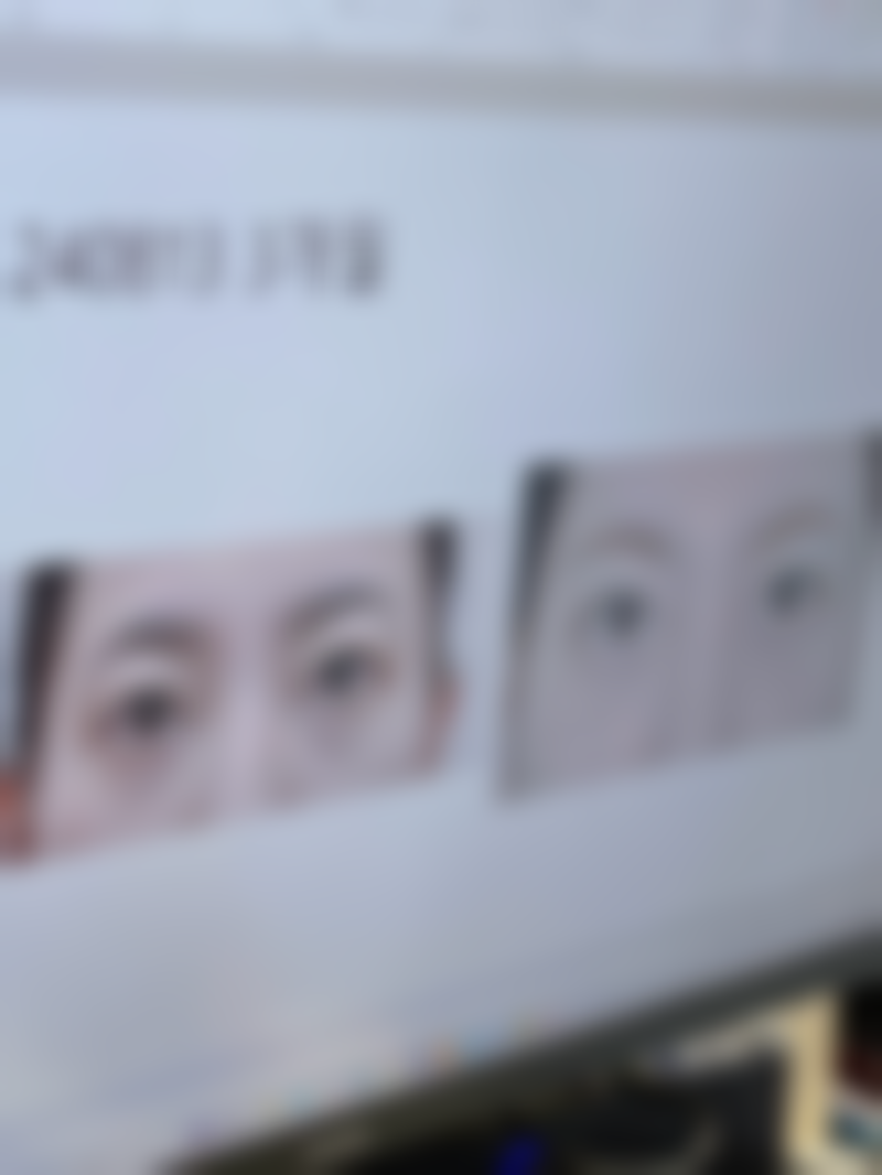 用什么贴去眼袋效果好？试试眼膜贴、中药贴，或许能助你轻松告别眼袋烦恼！ 