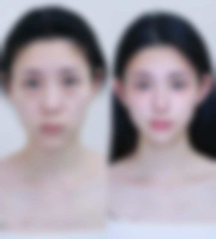 湘南学院附属医院(整形美容科)怎么预约