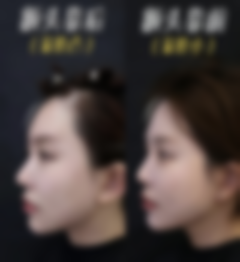 问题二:绿茶去眼袋成效如何,怎么用?