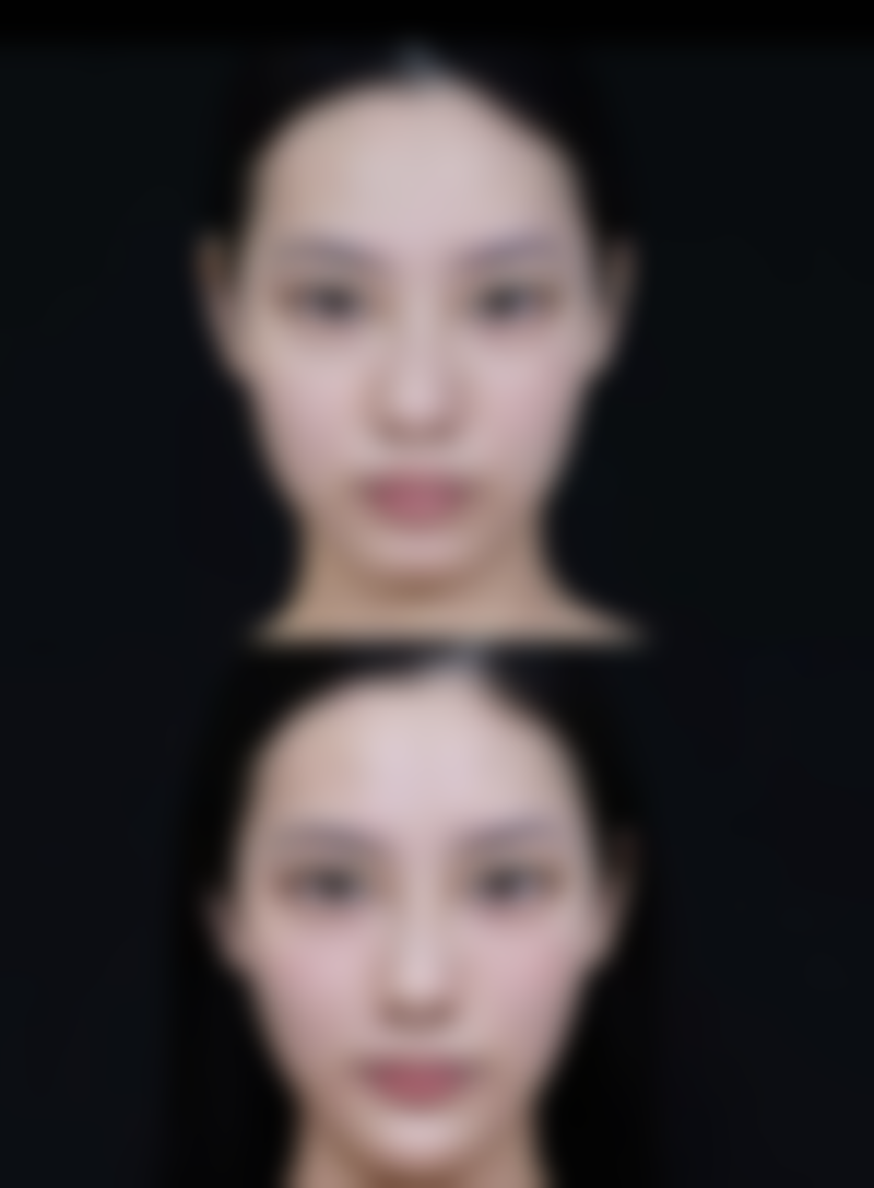 那为什么又说吸脂手术存在生命危险的可能呢?