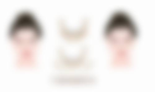 医院对割双眼皮手术成效有多大影响？