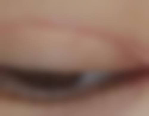 西安瑞丽诗植发 - 毛发移植怎么预约