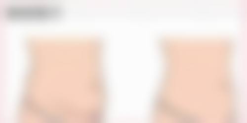 疤痕变白后在生活中要怎么护理呢？