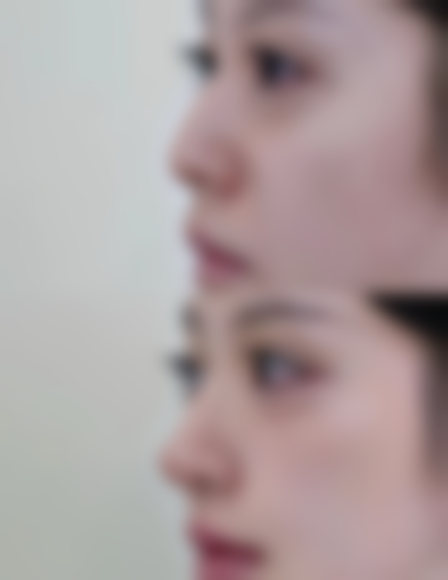 日常护理对去除眼袋有帮助吗？具体怎么做？