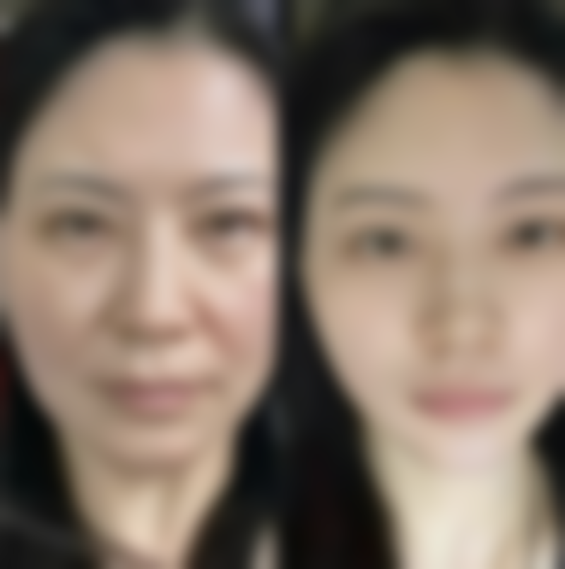 隆胸手术危险吗?属于大手术吗？其实风险可控，一般不算传统意义上的大型手术 