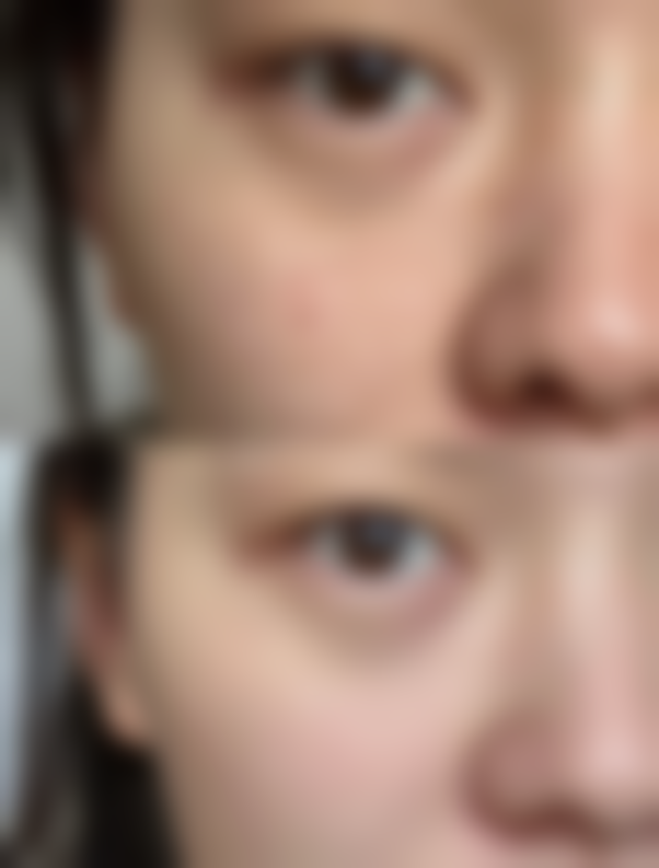 西安瑞丽诗植发 - 毛发移植口碑评价怎么样？