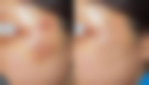 北京原力亿美医疗美容诊所正规吗？