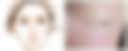 种植的毛发什么时候开始生长，什么时候能看到明显成效？