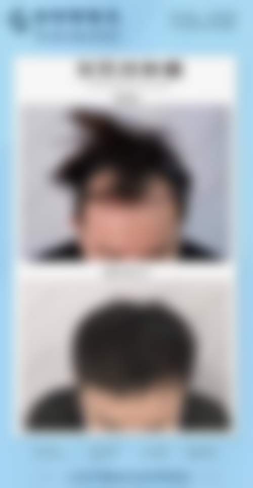 杭州德臻植发医院(杭州分院)