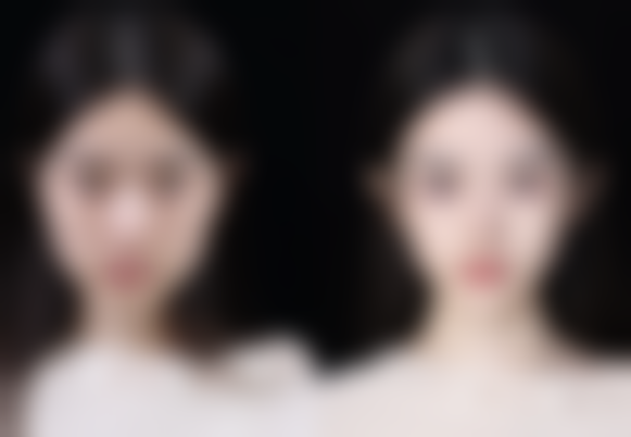 术后护理对看到成效的时间有什么作用？