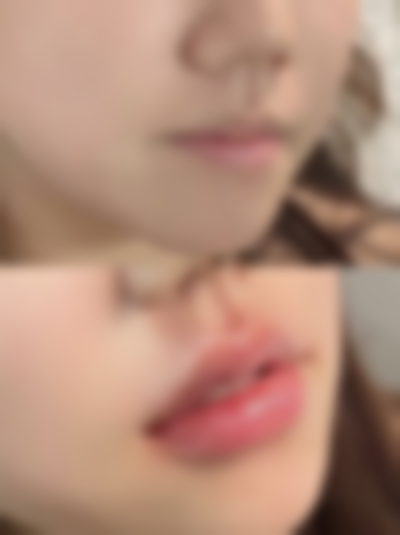 咸宁安美医疗美容门诊部李伟东医生眼部整形技术怎么样？