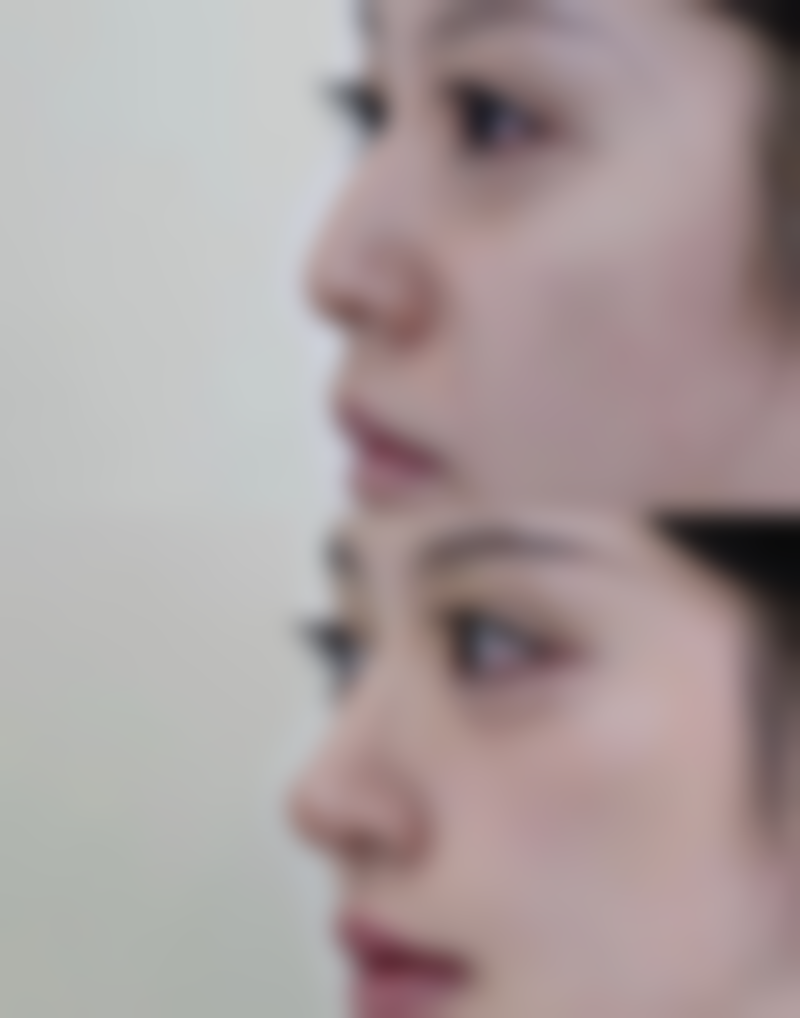 嘉兴千娇悦医疗美容诊所正规吗？