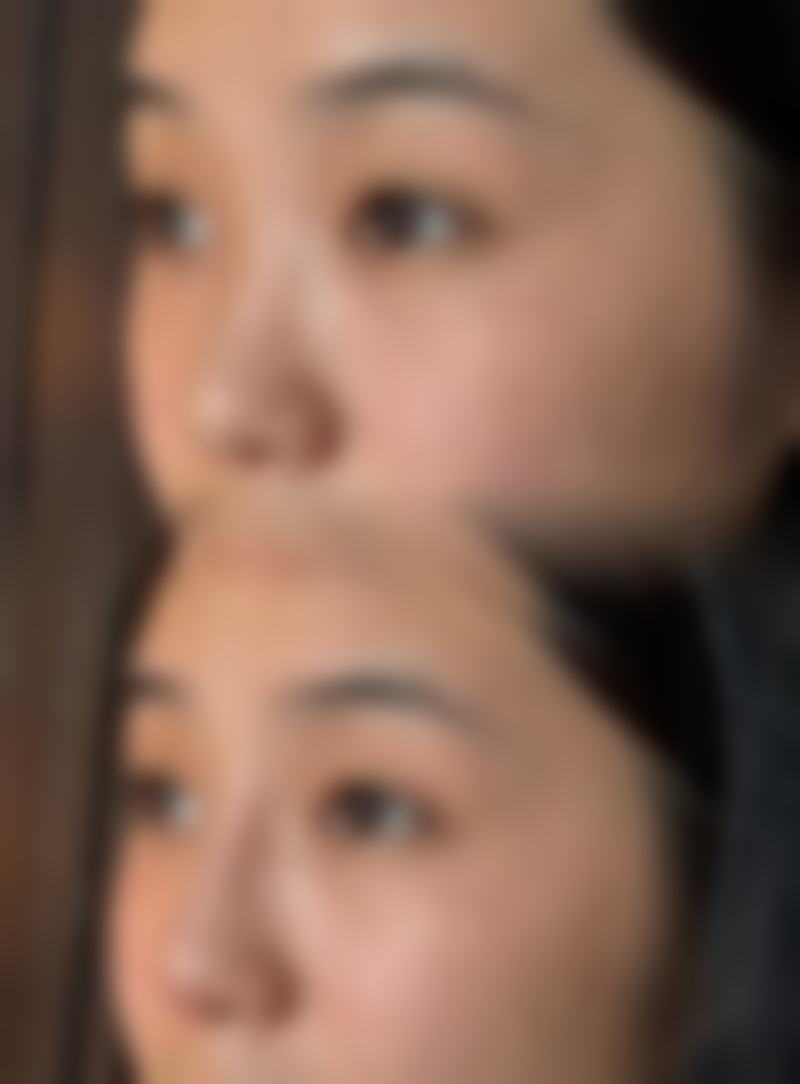 成都精美源医疗美容诊所党陈晔医生收费价格