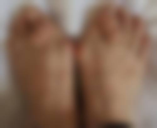 对于皮肤松弛的人，激光溶脂和吸脂该怎么选择呢？