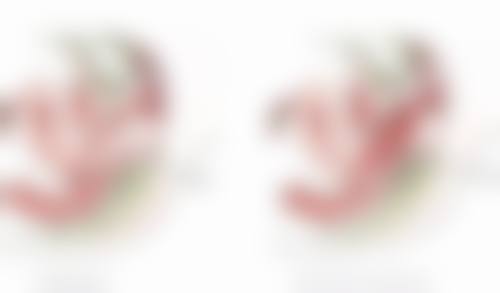 皮肤松弛型的眼袋该怎么改善呢？