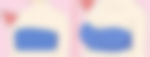 双眼皮有哪些美学特点呢？