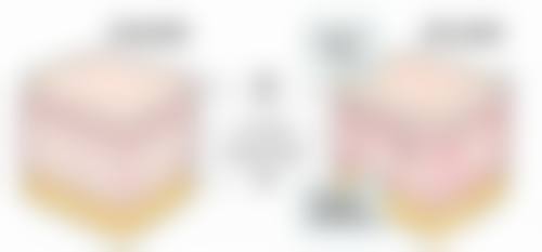 二氧化碳激光适合治疗什么样的黑色素疤痕?