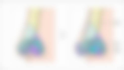 西安西 京医院整形外科耿健医生收费价格