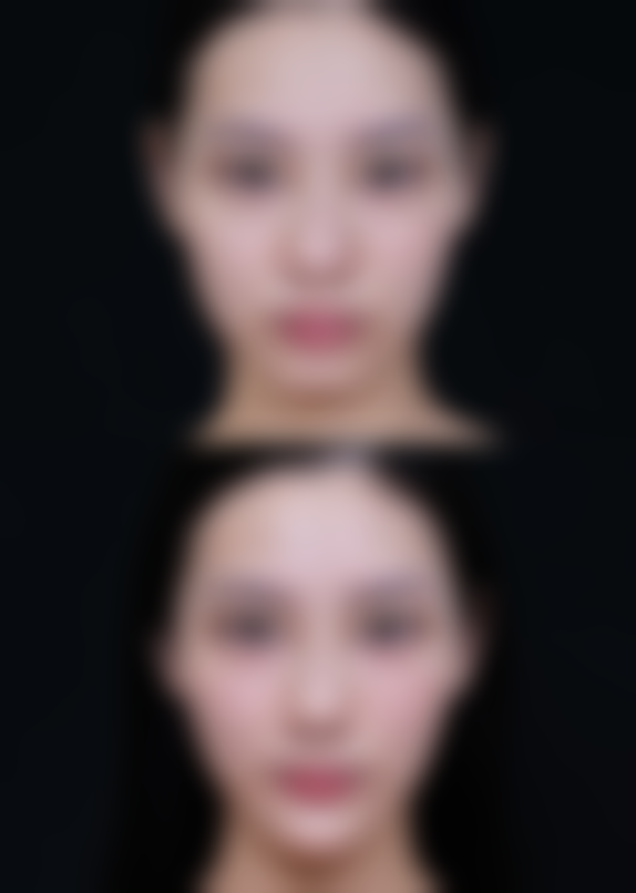 广州万和的假体有什么特点，适合哪些人群？