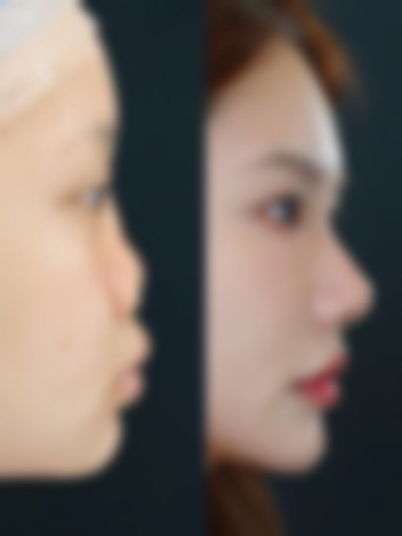 术前评估和讨论重要吗？和留疤有什么关系？