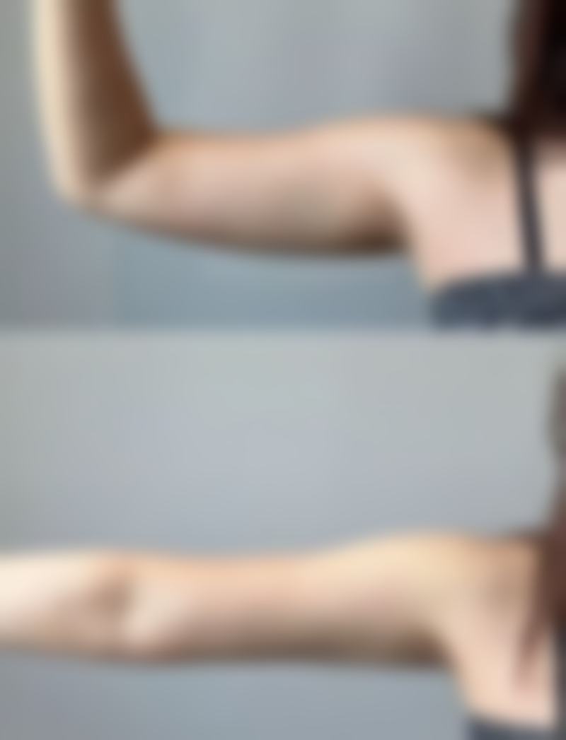 pretty整形外科医院口碑评价怎么样？