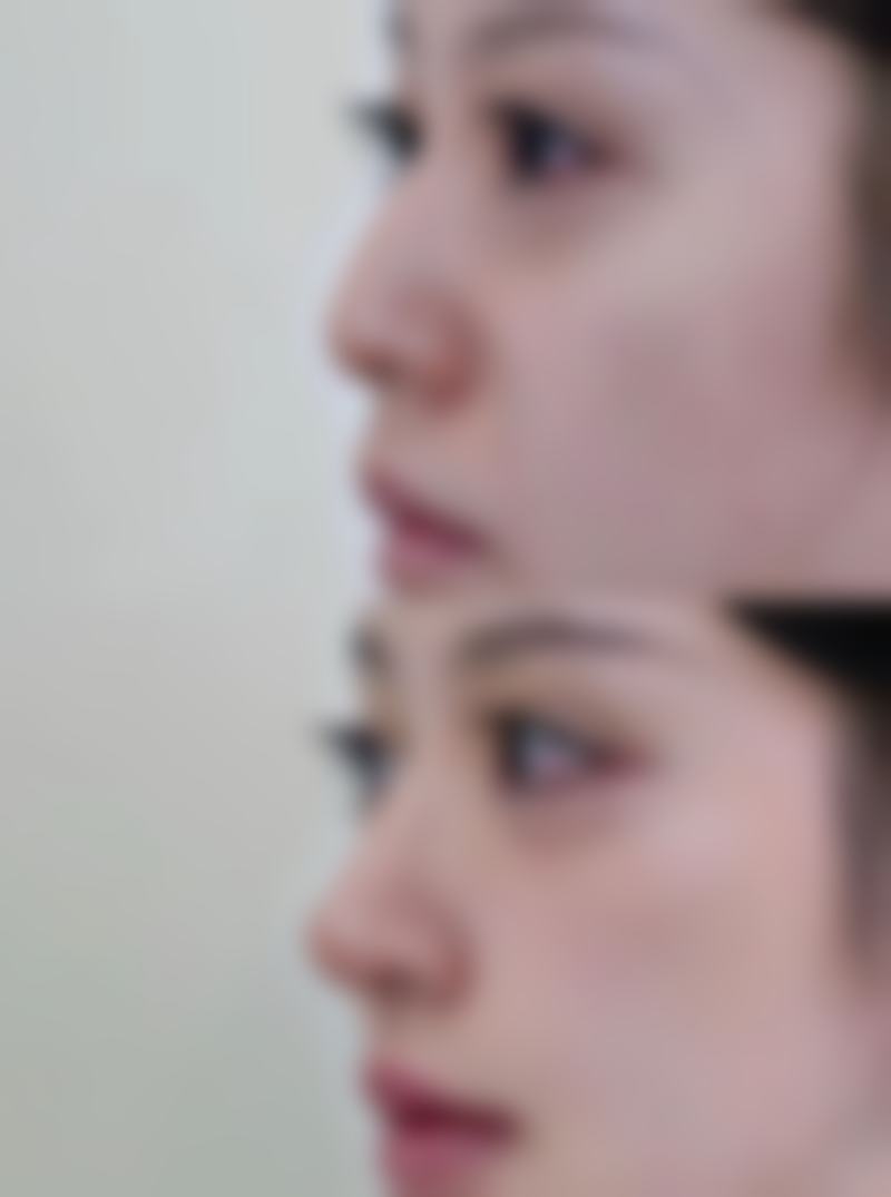 假体隆胸哪个品牌好？曼托、麦格、娜绮丽等知名品牌，谁才是你的理想之选？ 