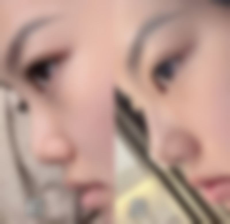 繁昌县人民医院整形美容科正规吗？