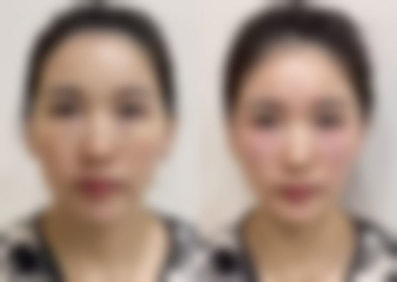 昆明卉颜整形医疗美容门诊部正规吗？