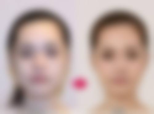 干皮人群适合用哪些去除眼袋的产品呢?