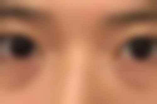 北京同林堂整形医疗美容口碑评价怎么样？