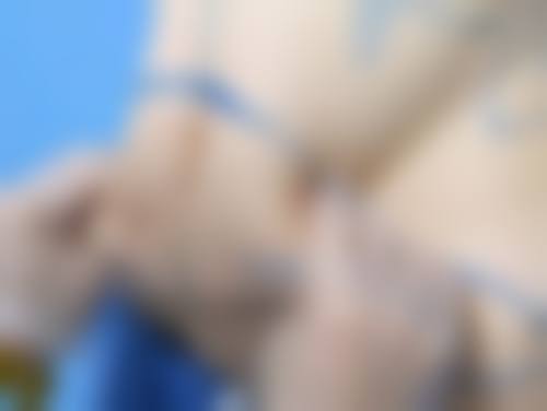 眼袋手术的风险大吗？正规操作、专业医生把关，其实风险可控不用过度担忧！ 