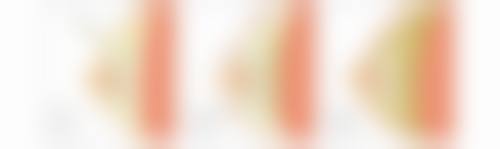 韩国winners整形外科医院怎么预约