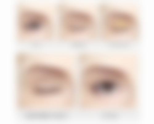 针对不同层次的色素沉着，有哪些医美干预方法呢？